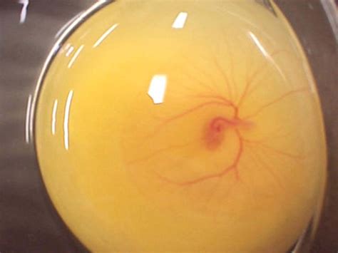 разширени вени в яйце може да повлияе на потентността